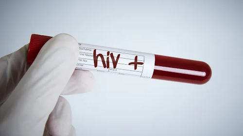 HIV Surrogacy in USA – A Safe & Supportive Path to Parenthood.png
