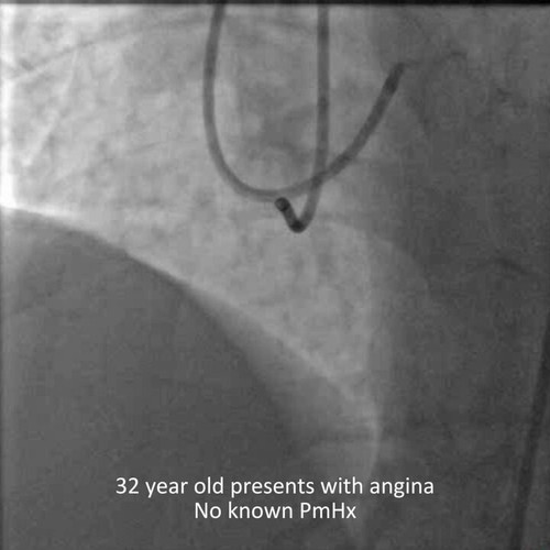 HW6 nYxr2bVS3m4t.jpg