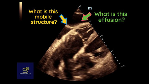 GfEI3E 23x7aYScz.jpg