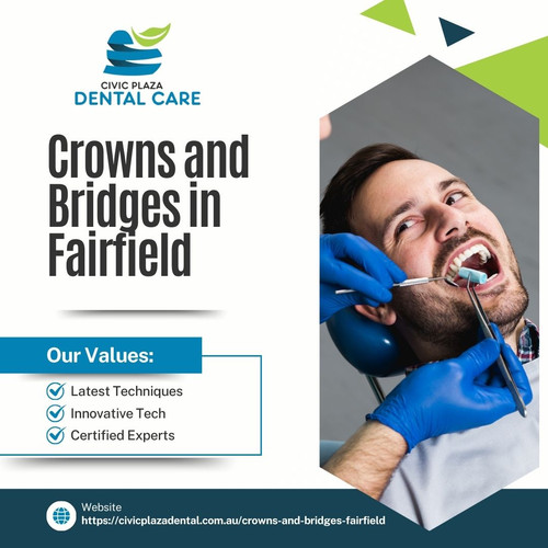 Enduring Smiles Reimagined Crafting Confidence with Crowns and Bridges in Fairfield Solar in Gold Co.jpg