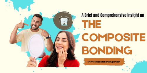 A Brief and Comprehensive Insight on the Composite Bonding.jpg