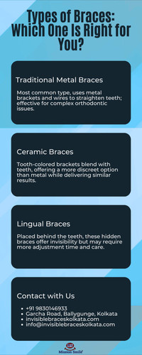 Types of Braces: Which One Is Right for You?.jpg