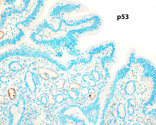 Gxn275eXMAAPM2i.jpg