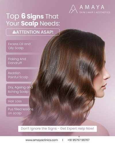 Best Hair Care Clinic In Hyderabad.jpg