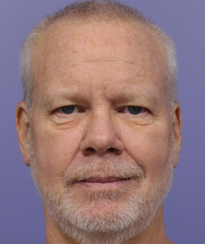 Screenshot 2025 08 08 173158.png