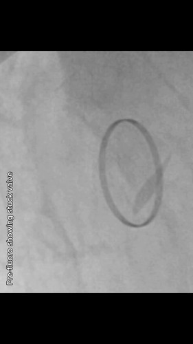 Bj1nNfgzGNP maem.jpg