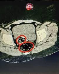 YmnIiPJXhmeERy1kUeGZ4N78bG3p6BBgJ76VY8fTlw10JZ40dFJrV FMdwshX 6vLwvX94EnhmRBfITI8g2JUMPUS KpQS4AY4ly.jpg