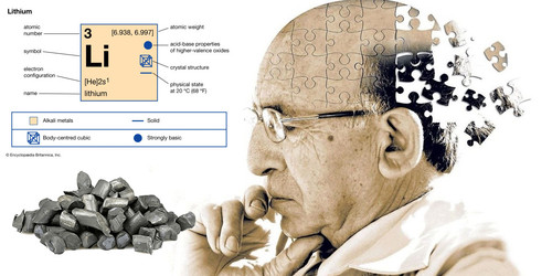 alzheimer2544.jpg
