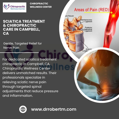 Sciatica Treatment & Chiropractic Care in Campbell, CA – Gentle, Targeted Relief for Nerve Pain.jpg