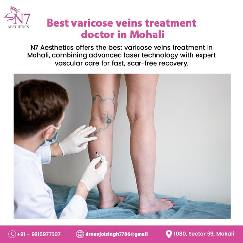 Best varicose veins treatment doctor in Mohali.jpg