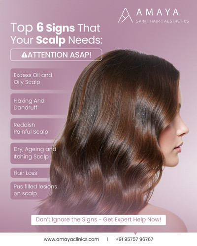 Best Prp Hair Treatment Hyderabad.jpg
