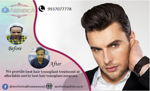 Hair Transplant in Bhubaneswar.png