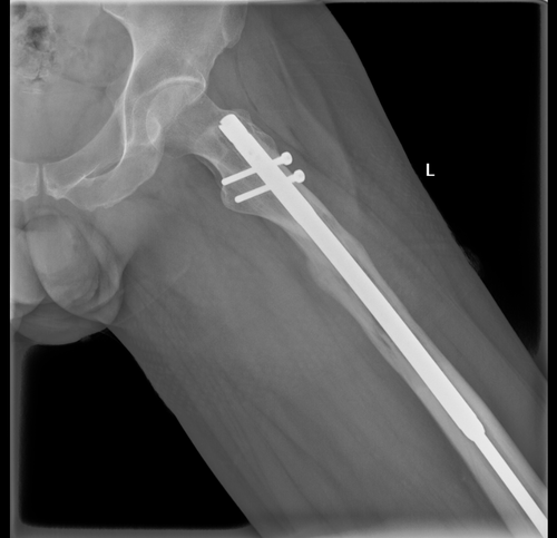 x ray left leg