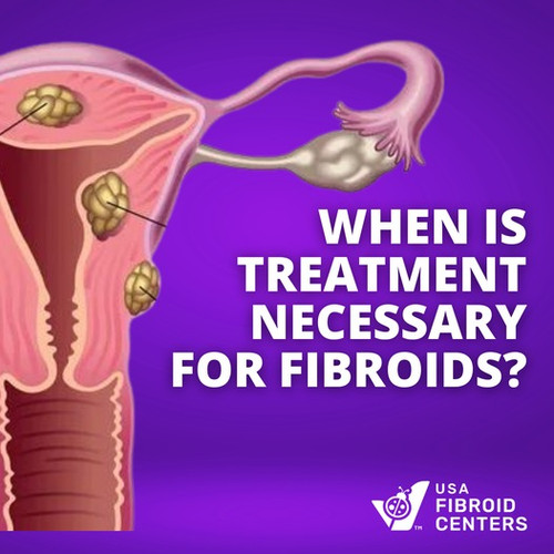 When Treatment is necessary For Fibroid.jpg