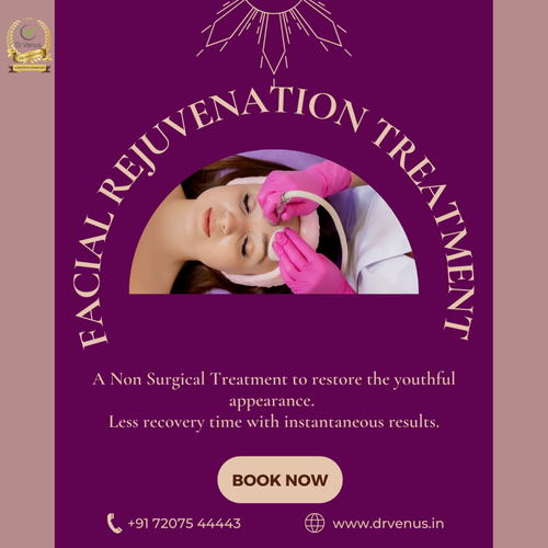 306275653 5641368769265965 330094941554111313 n.png