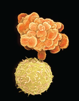 Apoptosis.png