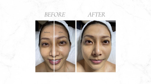 Bojin Facial Treatment – Carragheen.jpg