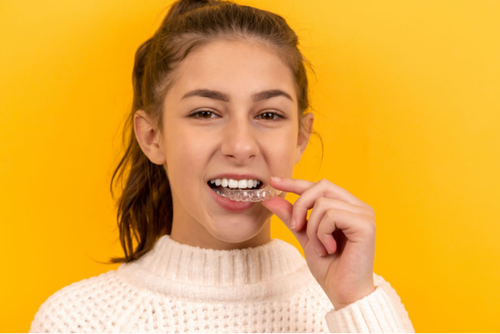 Benefits of Wearing Retainers (1).png
