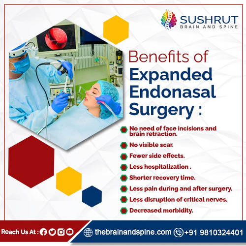 Benefits of Expanded Endonasal Surgery.jpg