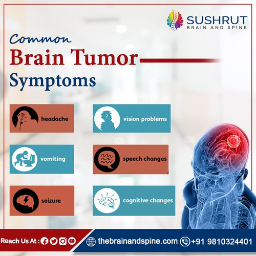 Common Brain Tumor Symptoms.jpg