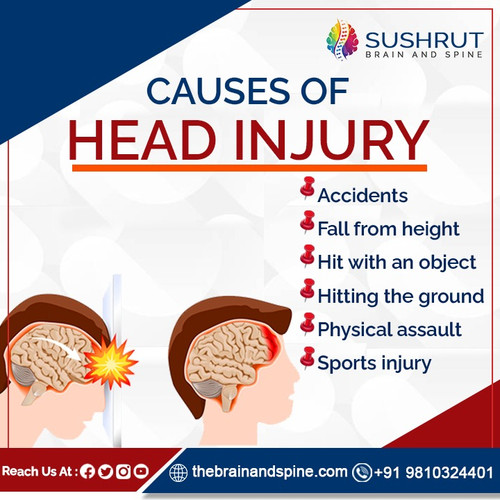 cause of head injury.jpg