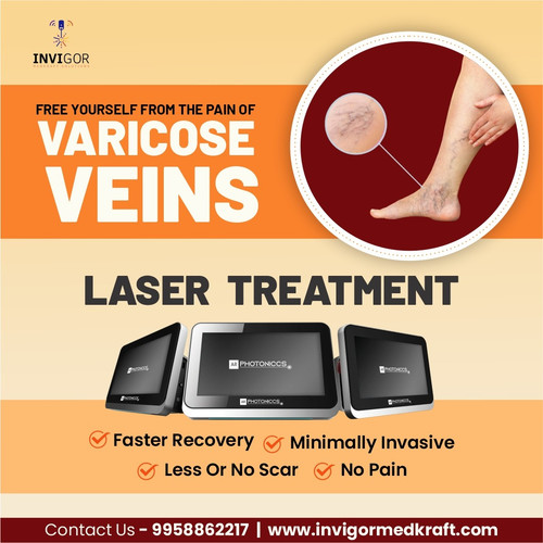 Laser for Varicose Veins Rental in India.jpg