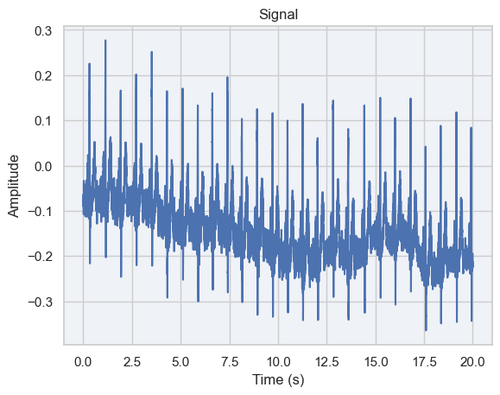 unfiltered signal.png