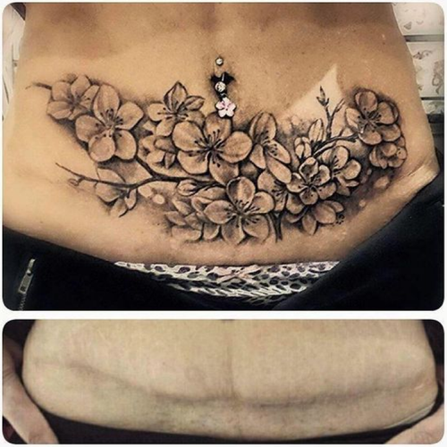 What can be covered up today is truly amazing. It is possible to conceal scars, stretch marks, and even some birthmarks in addition to old or undesirable tattoos. Call us at 918851988598. If you want to know more please visit our website shorturl.at/hGL67