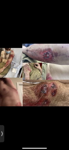 D6357909 820E 4CD4 96B2 1EC267EBAD1A.png