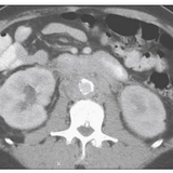 2023 06 15 15 38 44 (Eğitim Tanrısı) Alan Wein Campbell Walsh Urology 12th Edition Review Elsevier.png