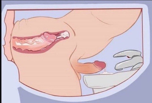 HRYXEOJ.md.jpg