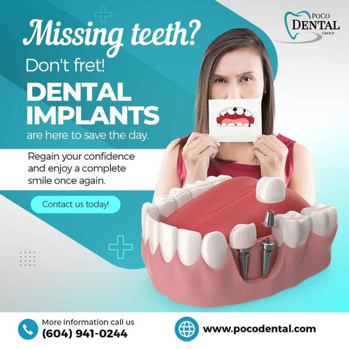 dental implants.jpg