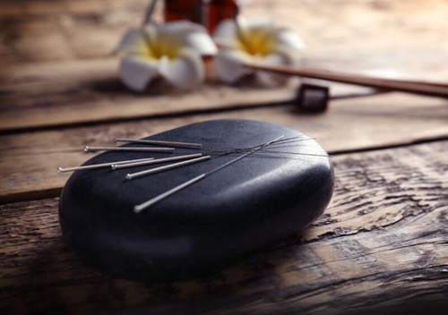 Acupuncture Adelaide.jpg
