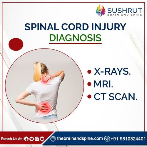 Spinal cord injury.jpg