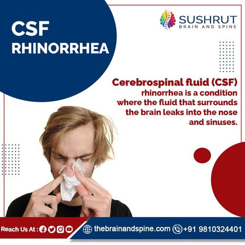 CSF Rhinorrhea Management.jpg