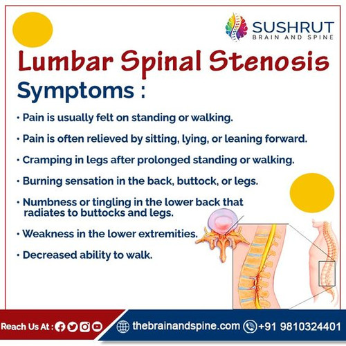 Lumbar Spinal Stenosis Symptoms.jpg