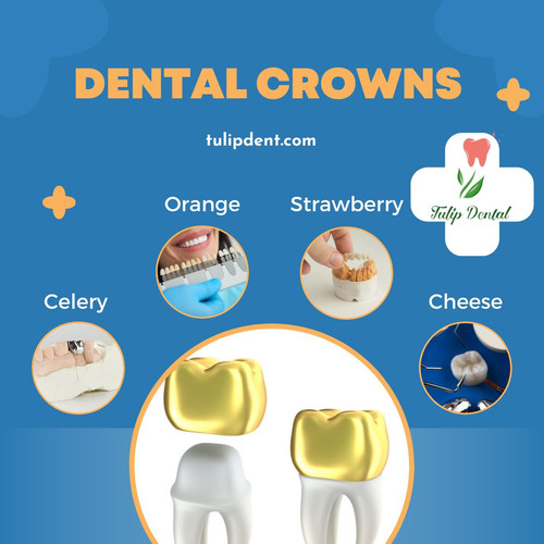 Dental crowns.jpg