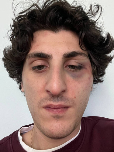 B57EE2D8 121E 430C ABD8 7F7F7CE23A82.jpg