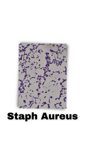 Staph Aureus.png