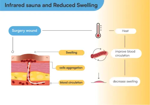 infrared sauna and swelling 2.webp