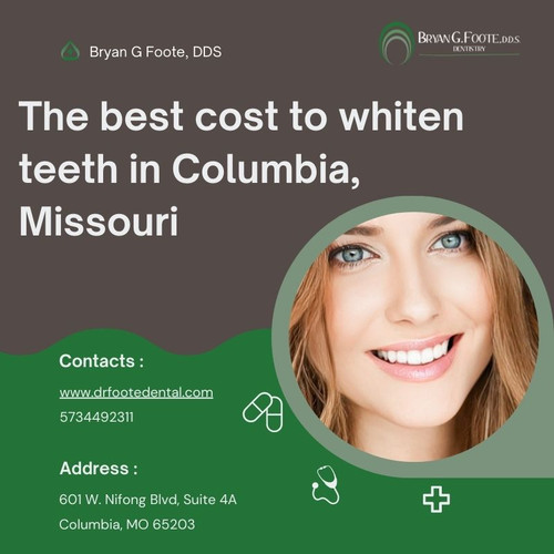 The best cost to whiten teeth in Columbia, Missouri.jpg