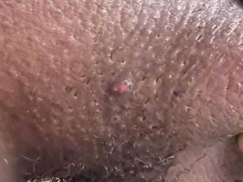 D77AAC7B 9EC7 446D 8173 F9052A089501