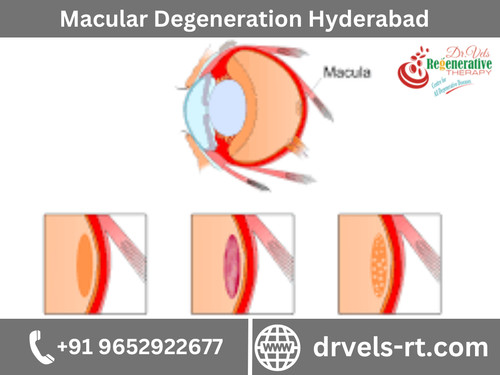 Dr. Vels Regenerative Therapys Stem cell therapy helps generate healthy cells that replace diseased .jpg