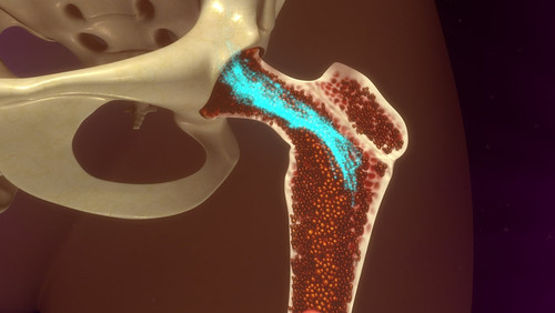 A Comprehensive Guide to Bone Marrow Donation & Myths.jpg