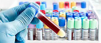 Phlebotomy Technician Program Los Angeles.jpg