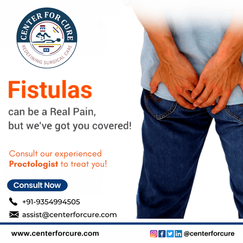 Laser Fistula Treatment.png