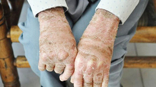 HIyfp3X.md.jpg