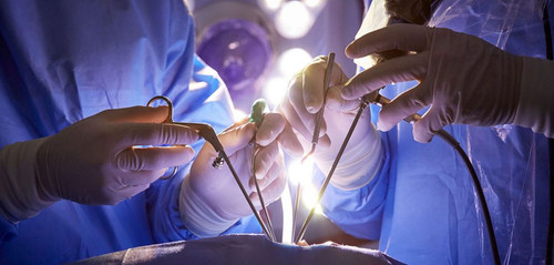 Minimally Invasive Surgery Devices