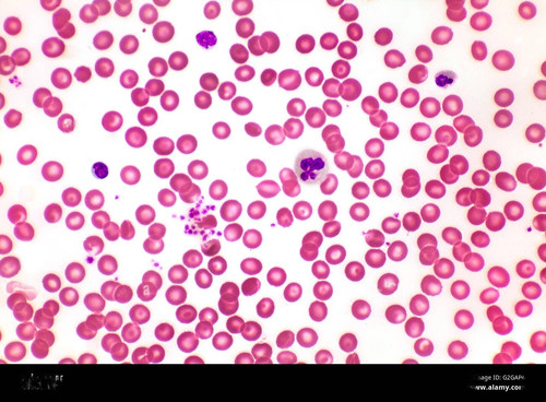 humano sano globulos blancos y rojos brightfield microfotografia g2gap4 transformed.jpg