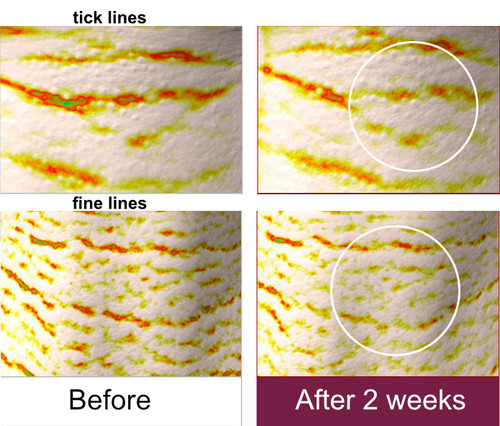 ckd neck cream results